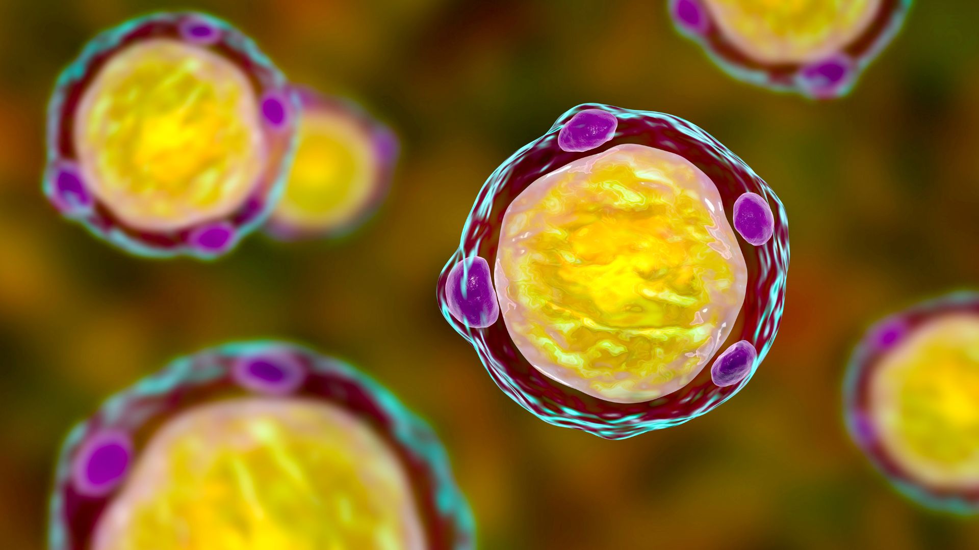 Mẹ bầu bị nhiễm vi khuẩn Mycoplasma hominis là nguyên nhân khiến ối vỡ sớm