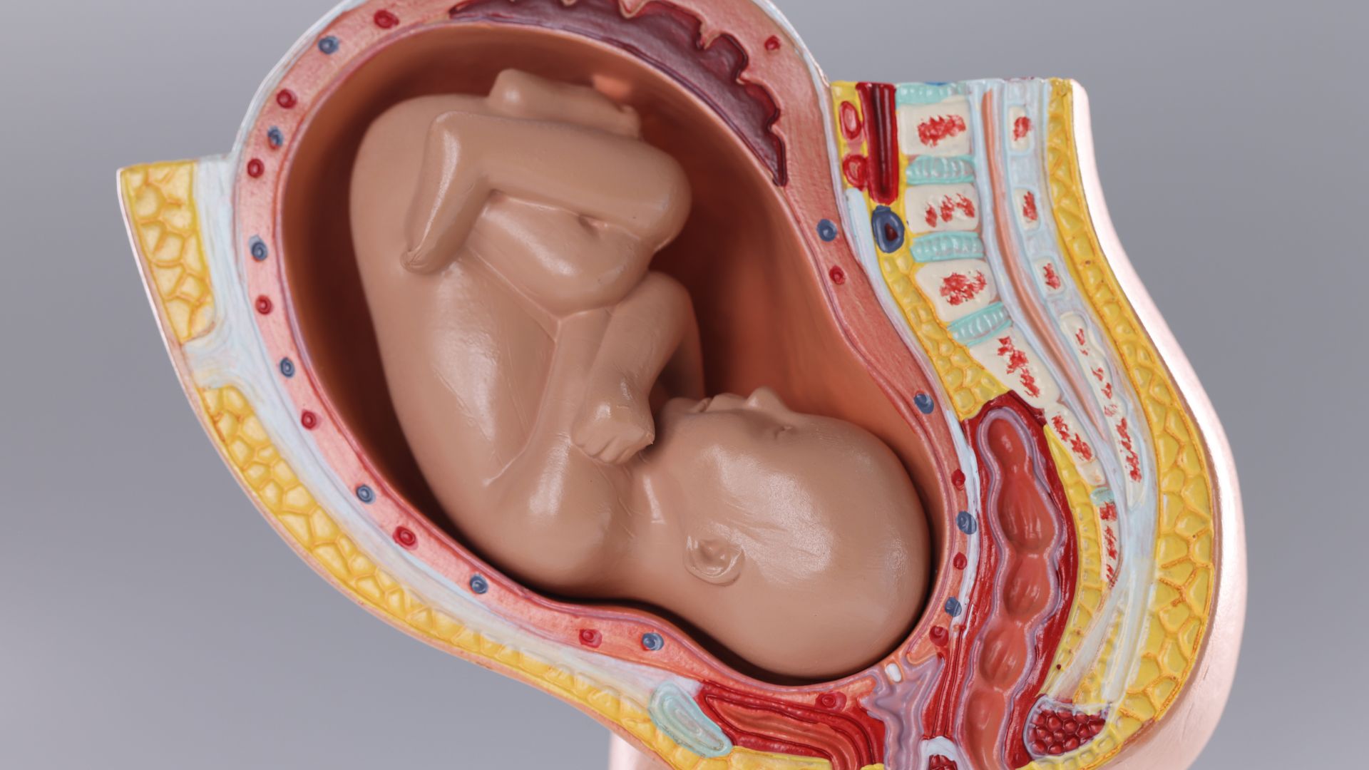 Rau tiền đạo cũng là nguyên nhân gây vỡ ối sớm