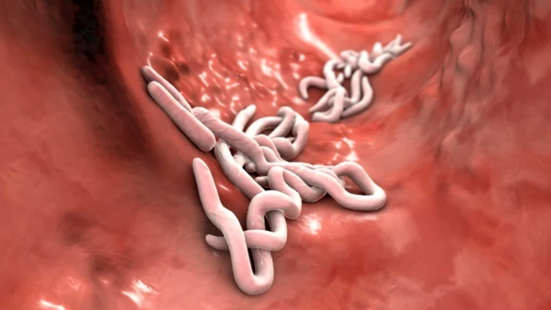 Phác đồ điều trị nhiễm ký sinh trùng giúp bác sĩ lựa chọn thuốc, liều lượng và thời gian điều trị phù hợp