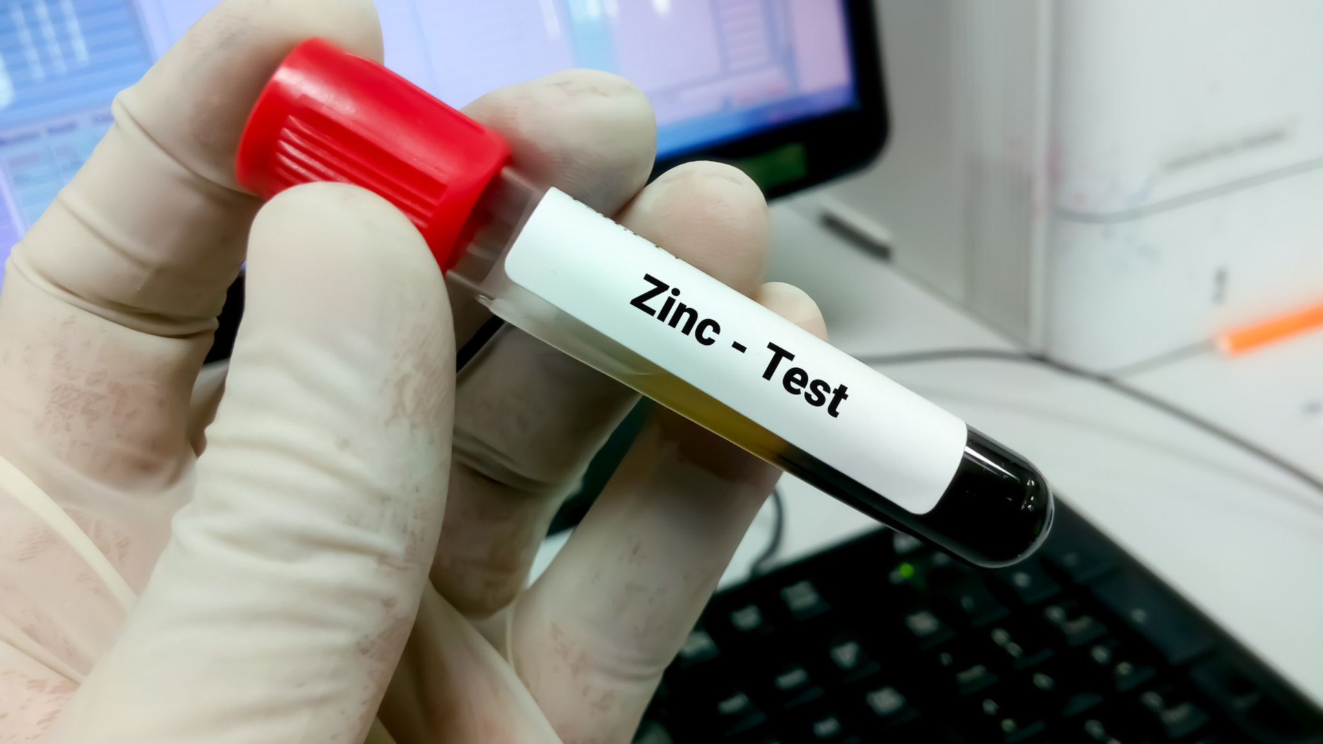 Kẽm sulfate thường được chỉ định trong trường hợp thiếu kẽm đã được xác định rõ ràng qua xét nghiệm