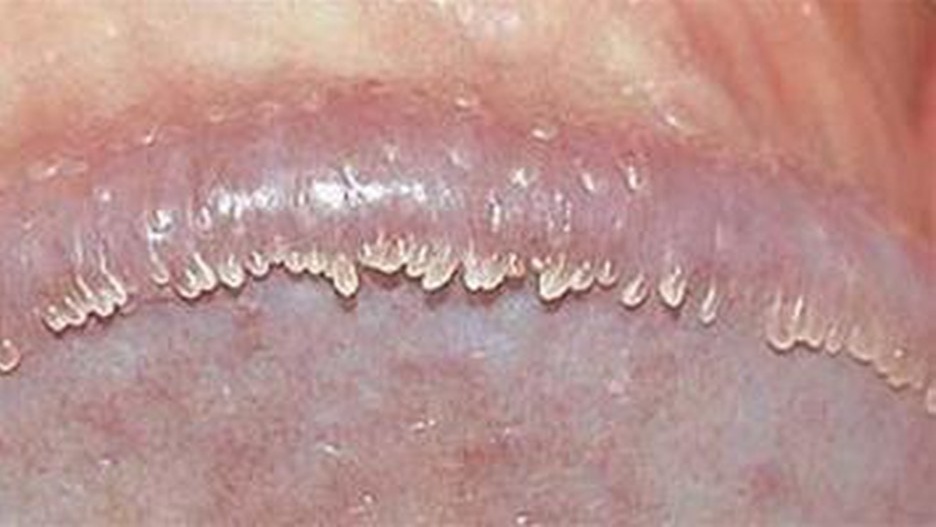 phan-biet-chuoi-hat-ngoc-va-sui-mao-ga-nhu-the-nao-2