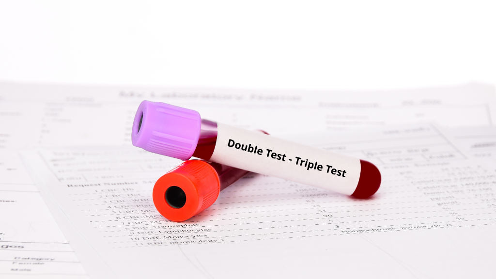 Double Test và Triple Test là hai xét nghiệm quan trọng trong sàng lọc dị tật thai nhi