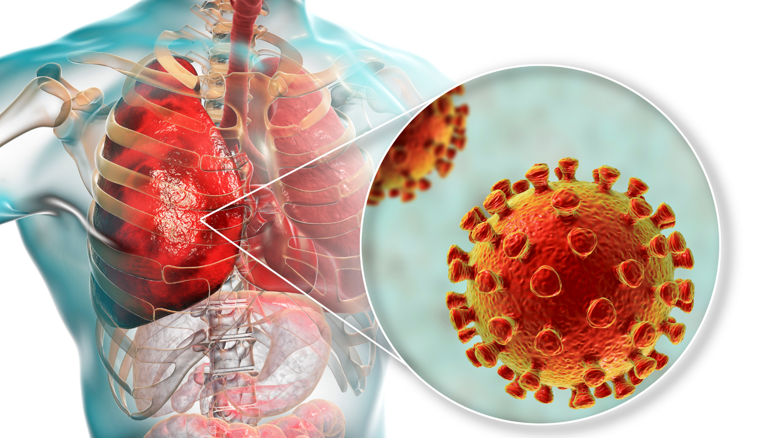 Gây các biến chứng như viêm phổi