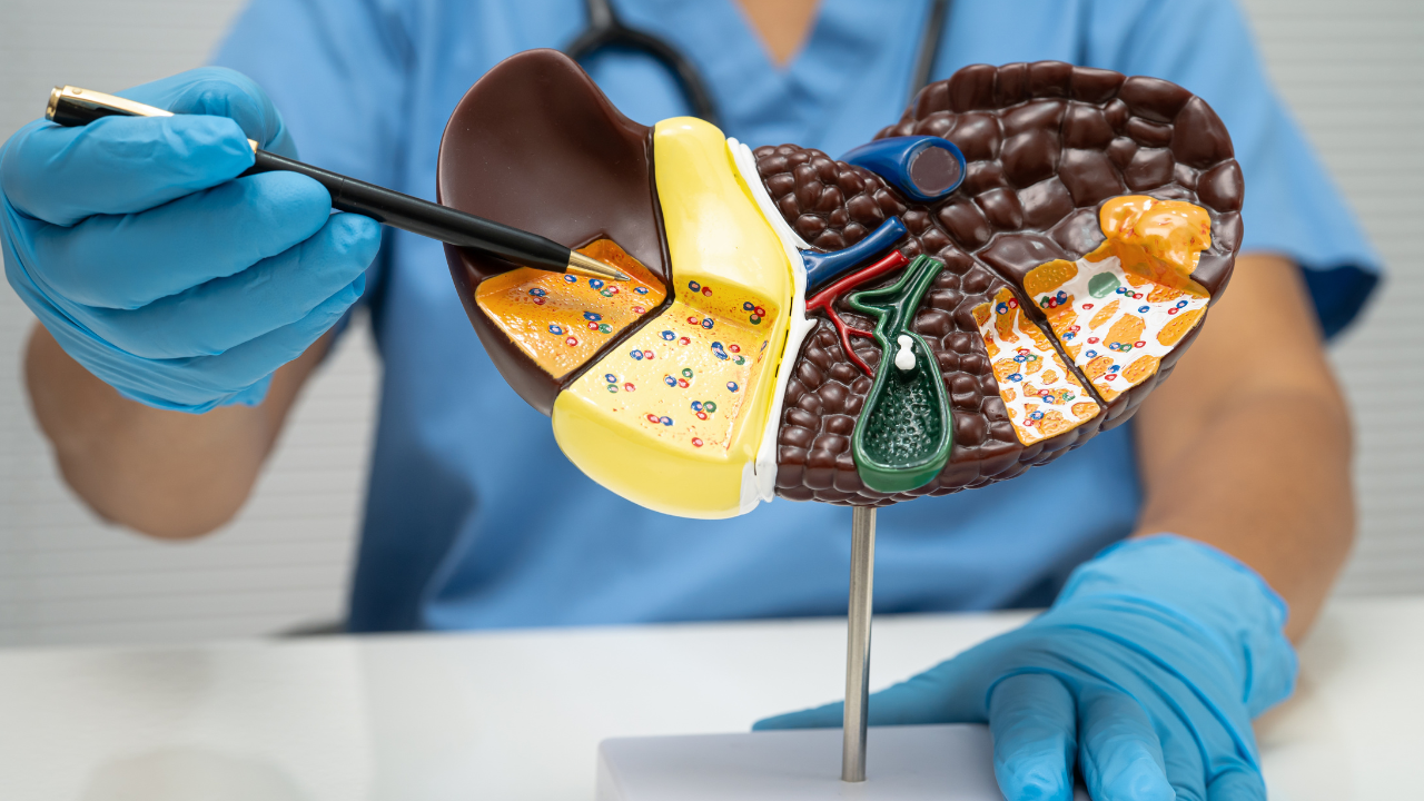 Thang điểm Child–Pugh truyền thống được tính dựa trên 5 tiêu chí