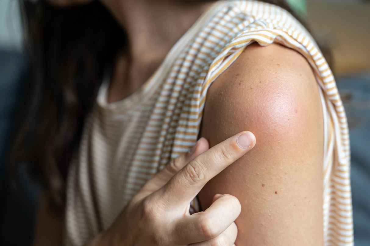 phan-ung-sau-khi-tiem-vac-xin-nhung-dieu-can-biet 1.png