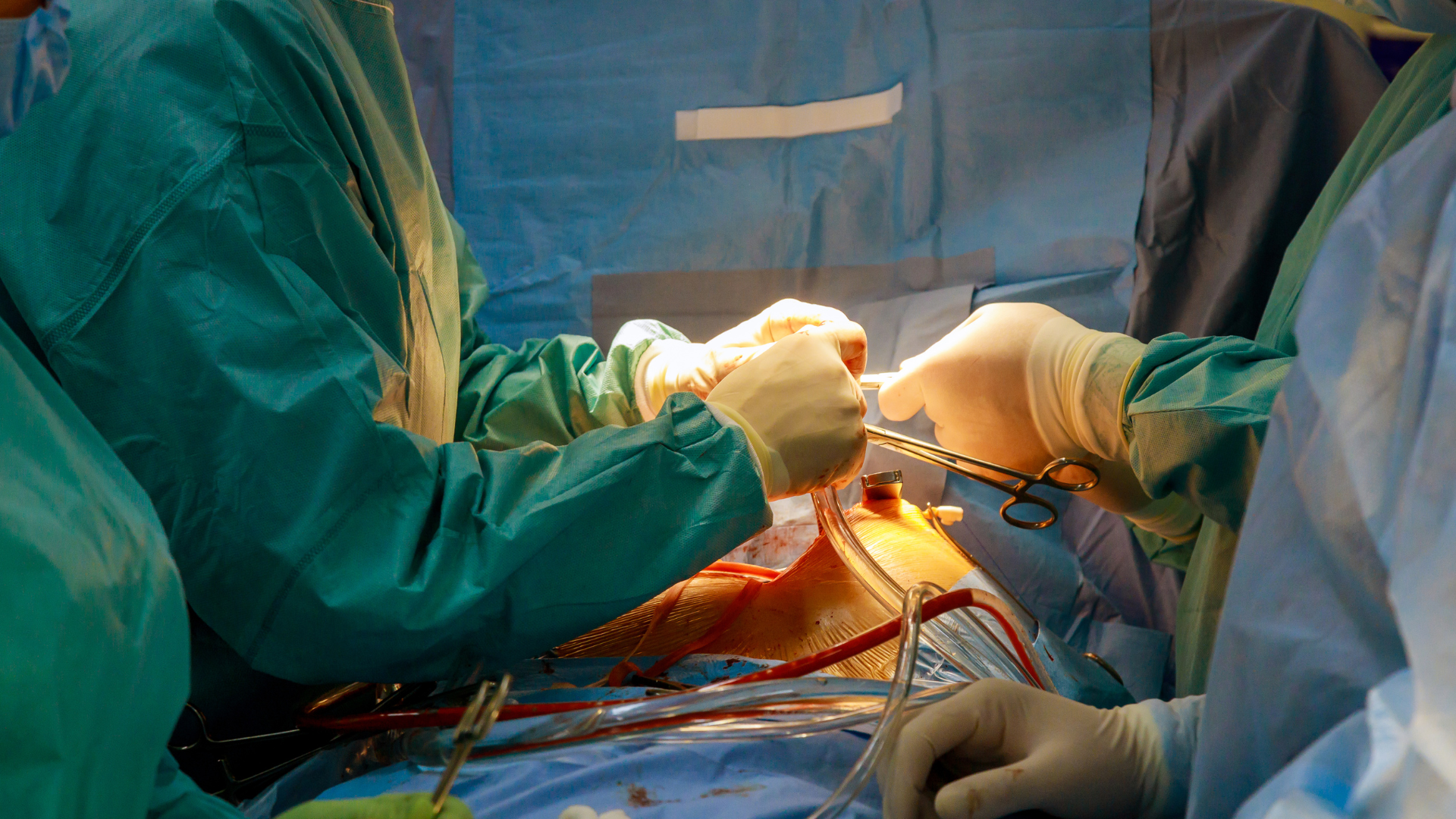 Phẫu thuật hở van tim hết bao nhiêu tiền? Hiểu rõ chi phí để an tâm điều trị