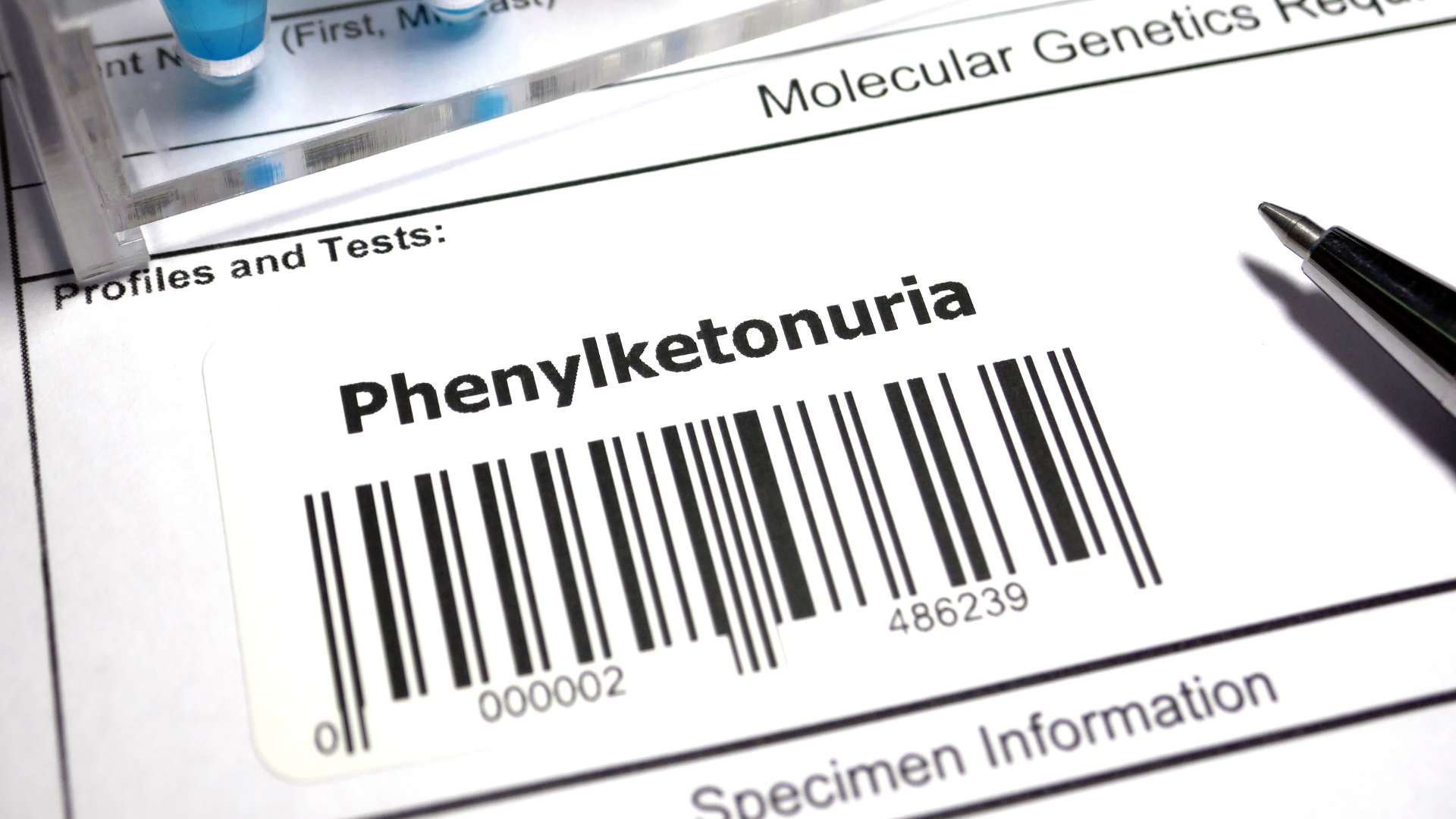 Phenylketone niệu (PKU) là một bệnh lý rối loạn chuyển hóa axit amin bẩm sinh