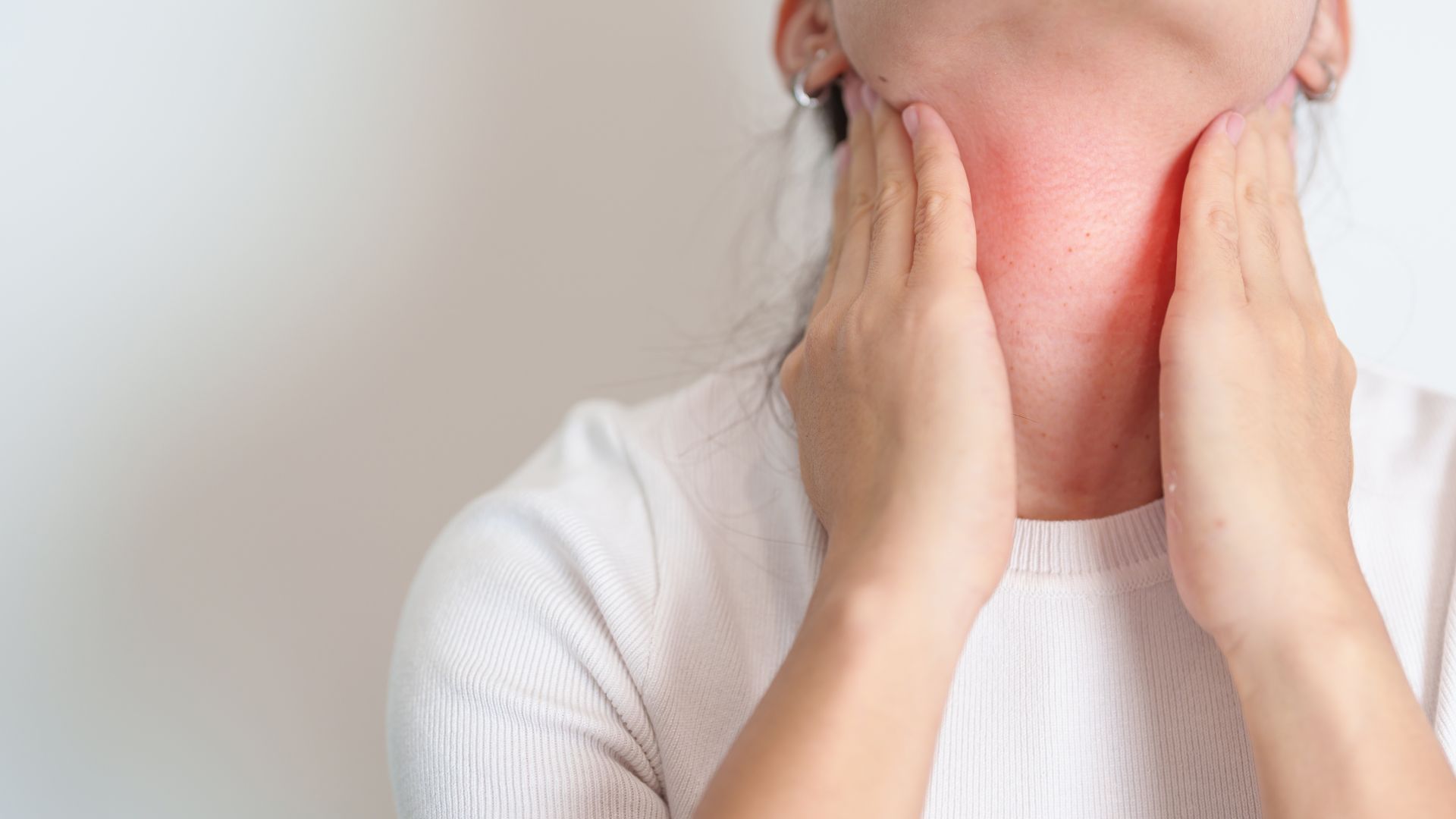 Viêm giáp Hashimoto có thể dẫn đến phình giáp