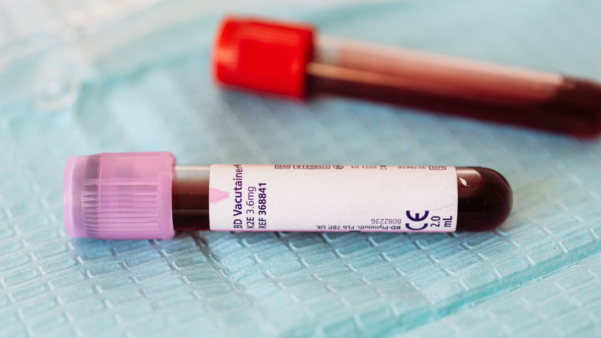 Xét nghiệm máu kiểm tra nồng độ hormone tuyến giáp hỗ trợ chẩn đoán bệnh phình giáp