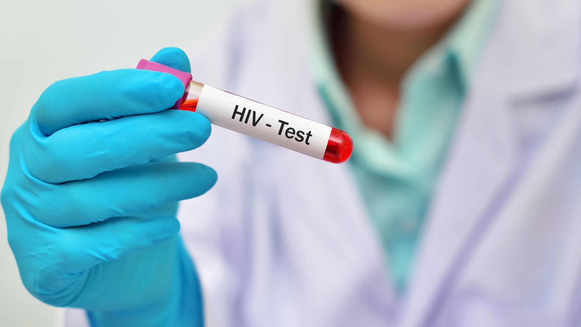 Việc thực hiện xét nghiệm HIV theo đúng thời điểm vẫn là cách duy nhất để xác định tình trạng nhiễm bệnh