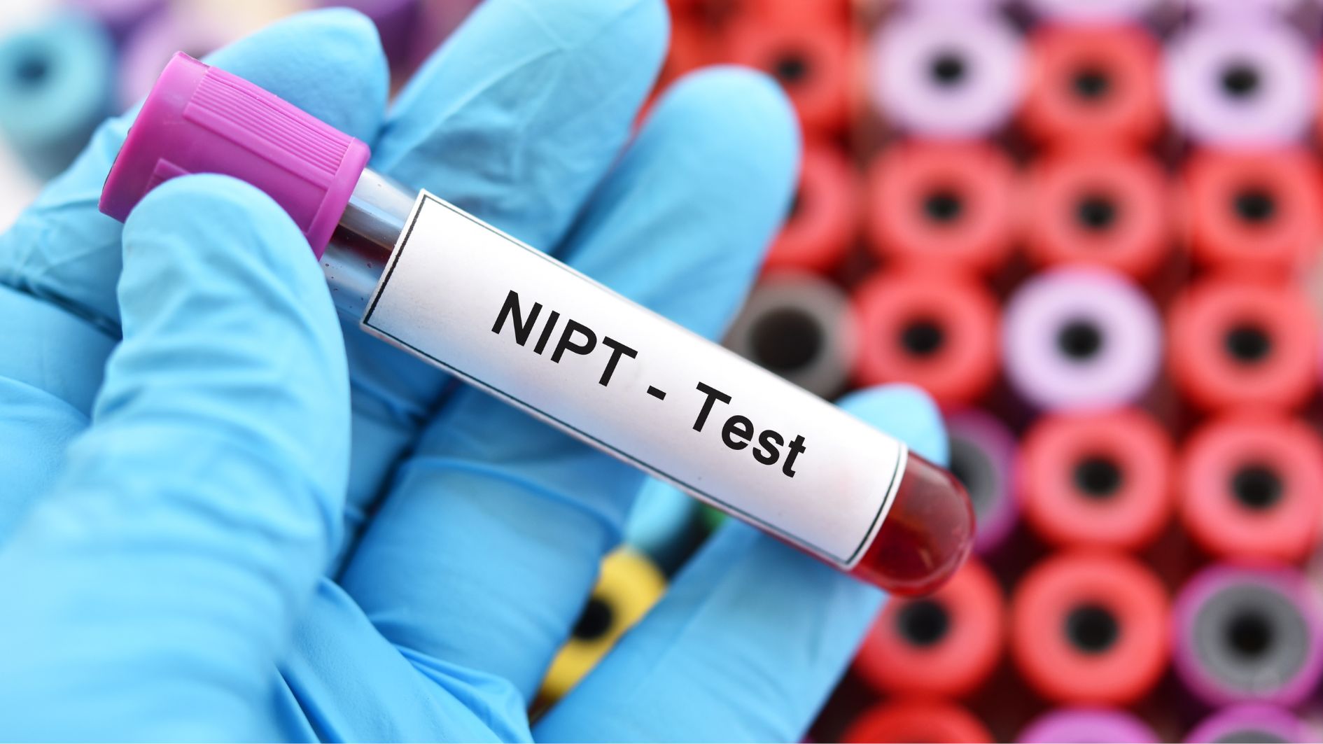 Xét nghiệm NIPT là phương pháp xét nghiệm giới tính thai nhi sớm