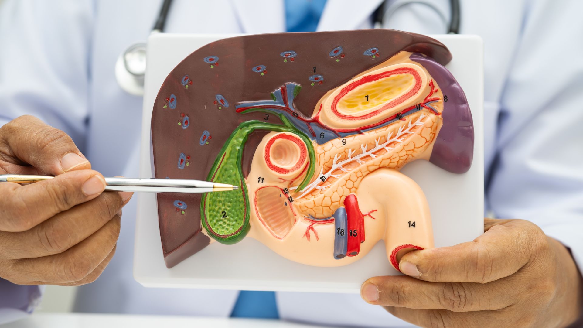 Polyp túi mật lớn hơn 10mm có thể tiến triển thành polyp ác tính