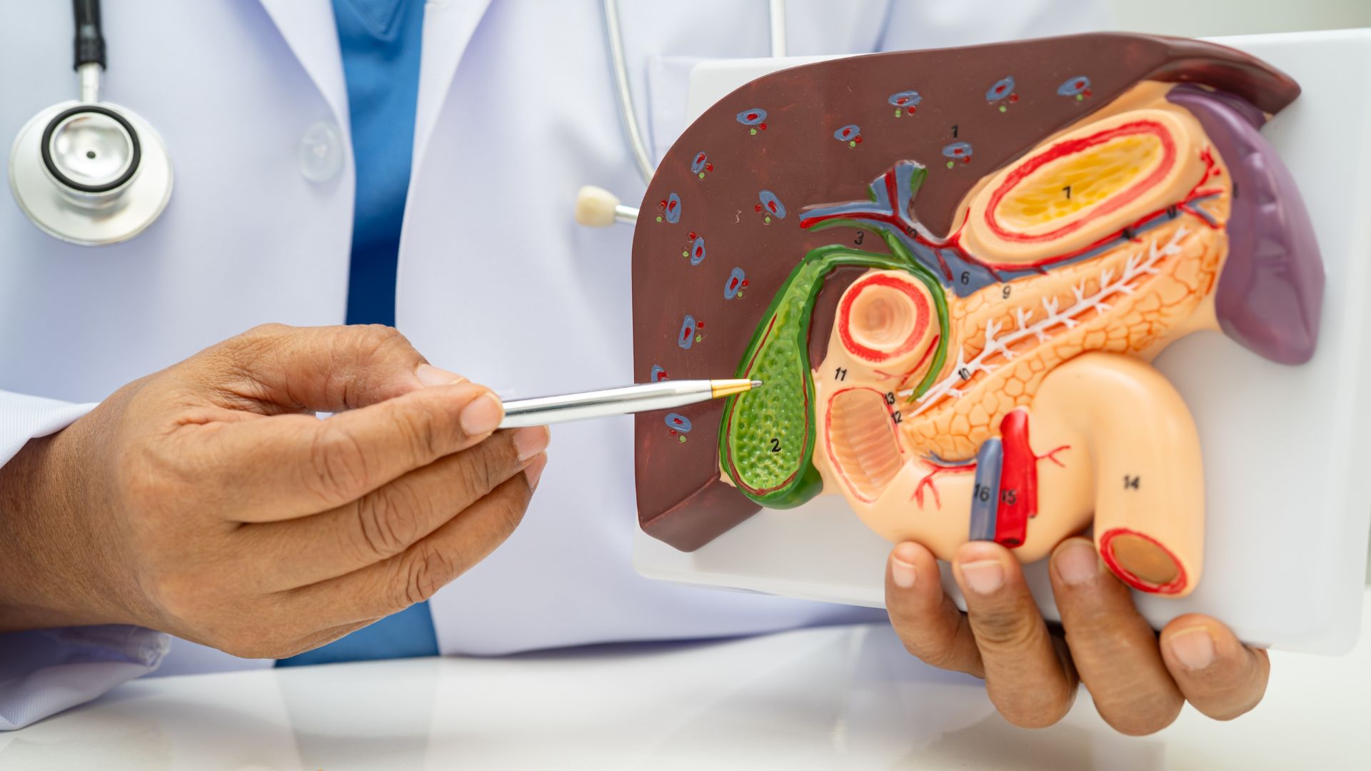 Polyp túi mật dưới 5mm cần được theo dõi thường xuyên để đánh giá tình trạng bệnh