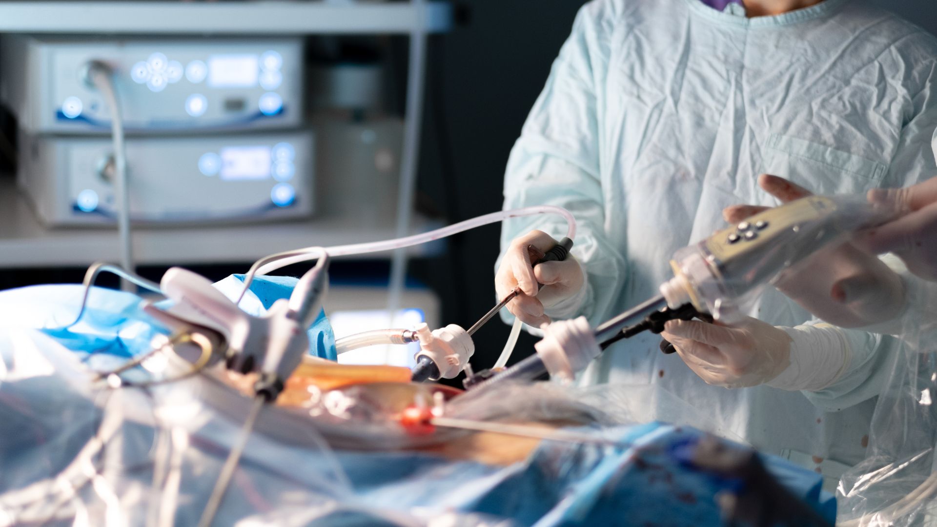 Cắt bỏ túi mật giúp loại bỏ hoàn toàn túi mật, phòng ngừa nguy cơ tiến triển ác tính