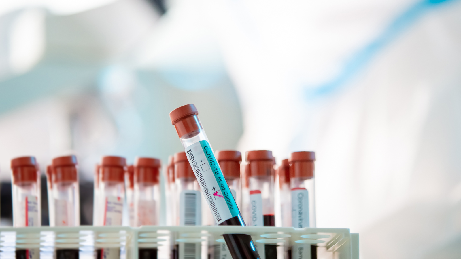 Positive là gì trong xét nghiệm​? Là xét nghiệm đã phát hiện ra bệnh hoặc dấu ấn sinh học mà bác sĩ đang tìm kiếm