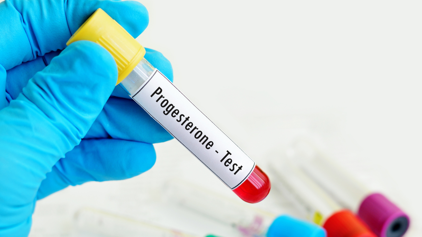 Progesterone thấp có sao không? Những điều phụ nữ nên biết 3