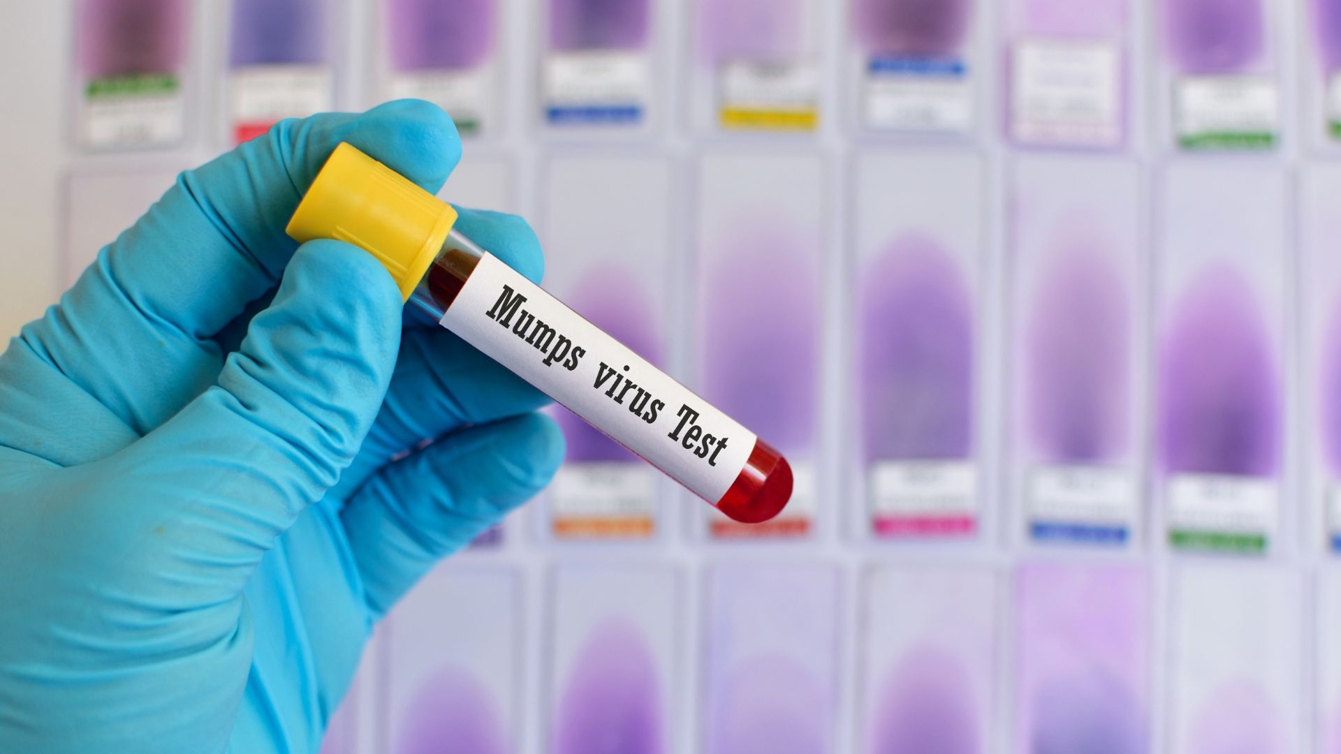 quai-bi-trieu-chung-nguyen-nhan-chan-doan-dieu-tri-va-phong-ngua 3.jpg