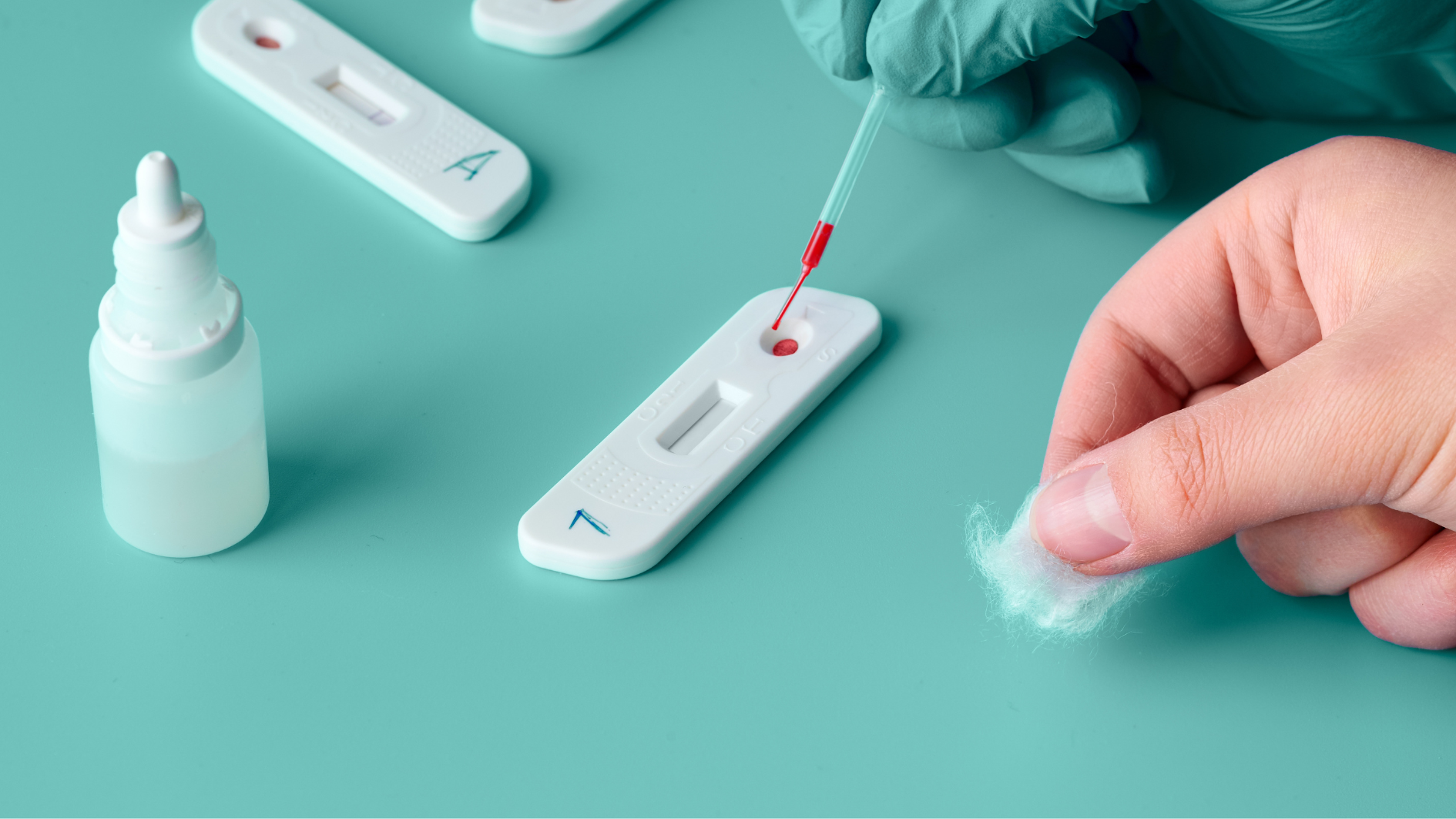 Que thử giang mai có chính xác không phụ thuộc vào nhiều yếu tố