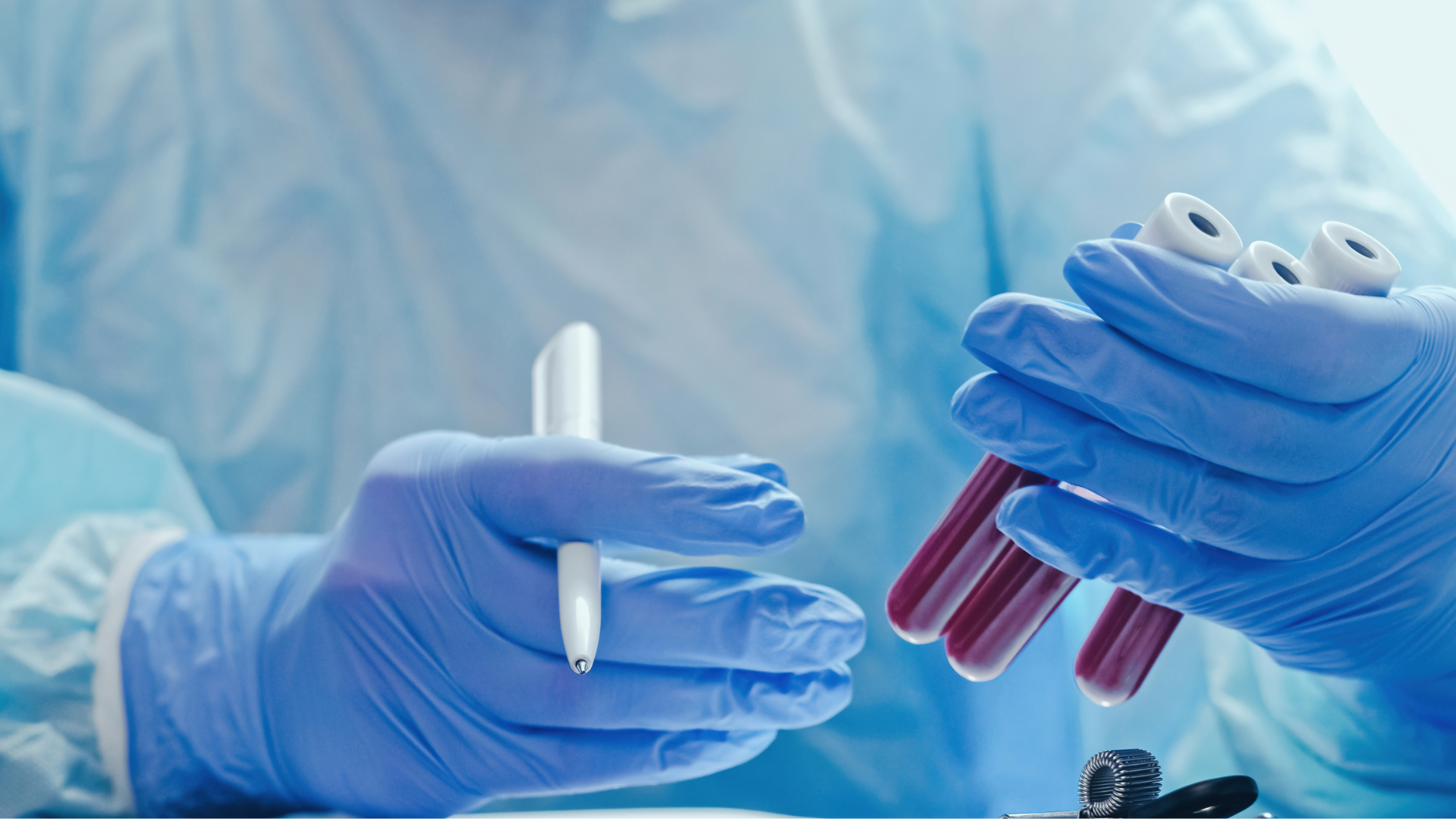 Xét nghiệm huyết thanh giúp sàng lọc giang mai