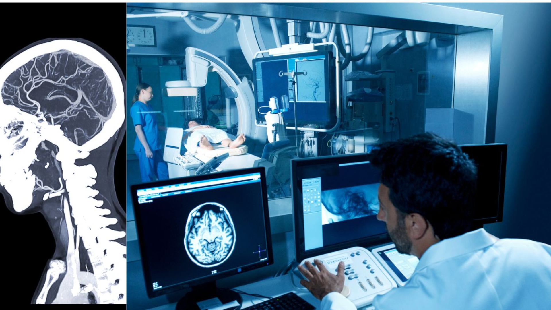 Chụp CT mạch máu não sử dụng tia X kết hợp với máy tính để tạo ra hình ảnh chi tiết của hệ thống mạch máu trong não