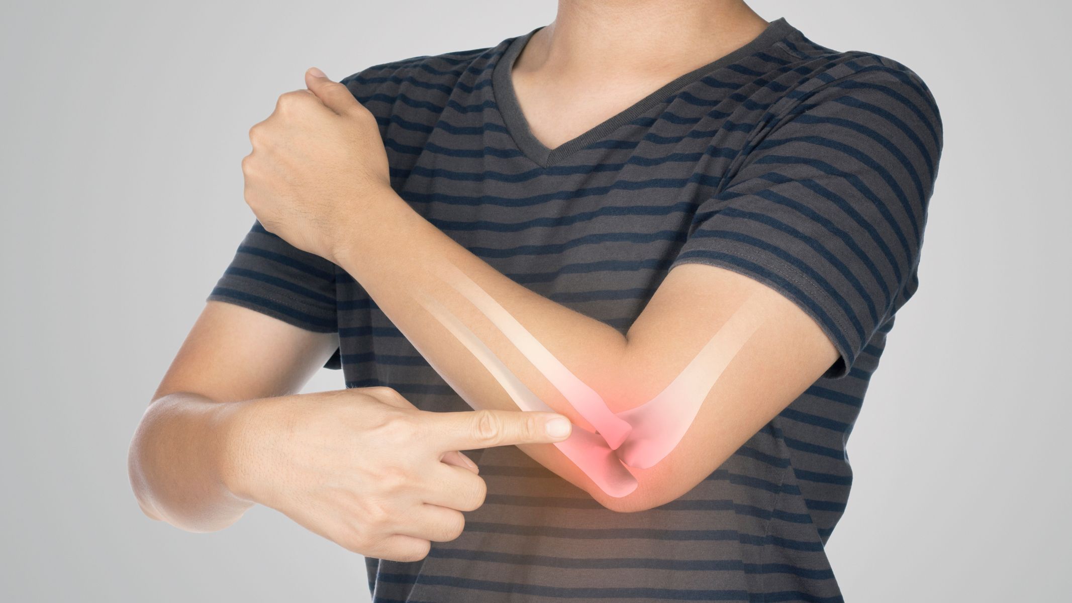 Rạn xương bao lâu thì khỏi?