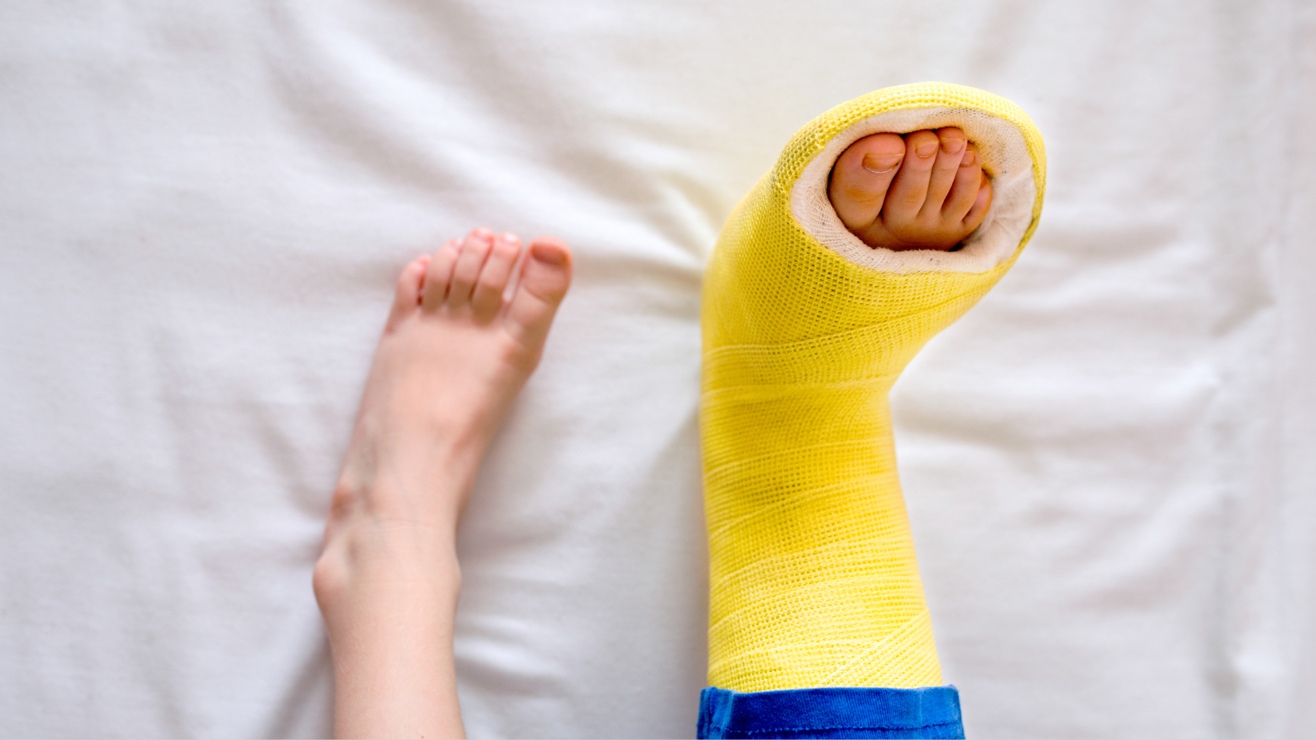 Ở trẻ em, vết rạn xương thường hồi phục nhanh hơn so với người lớn