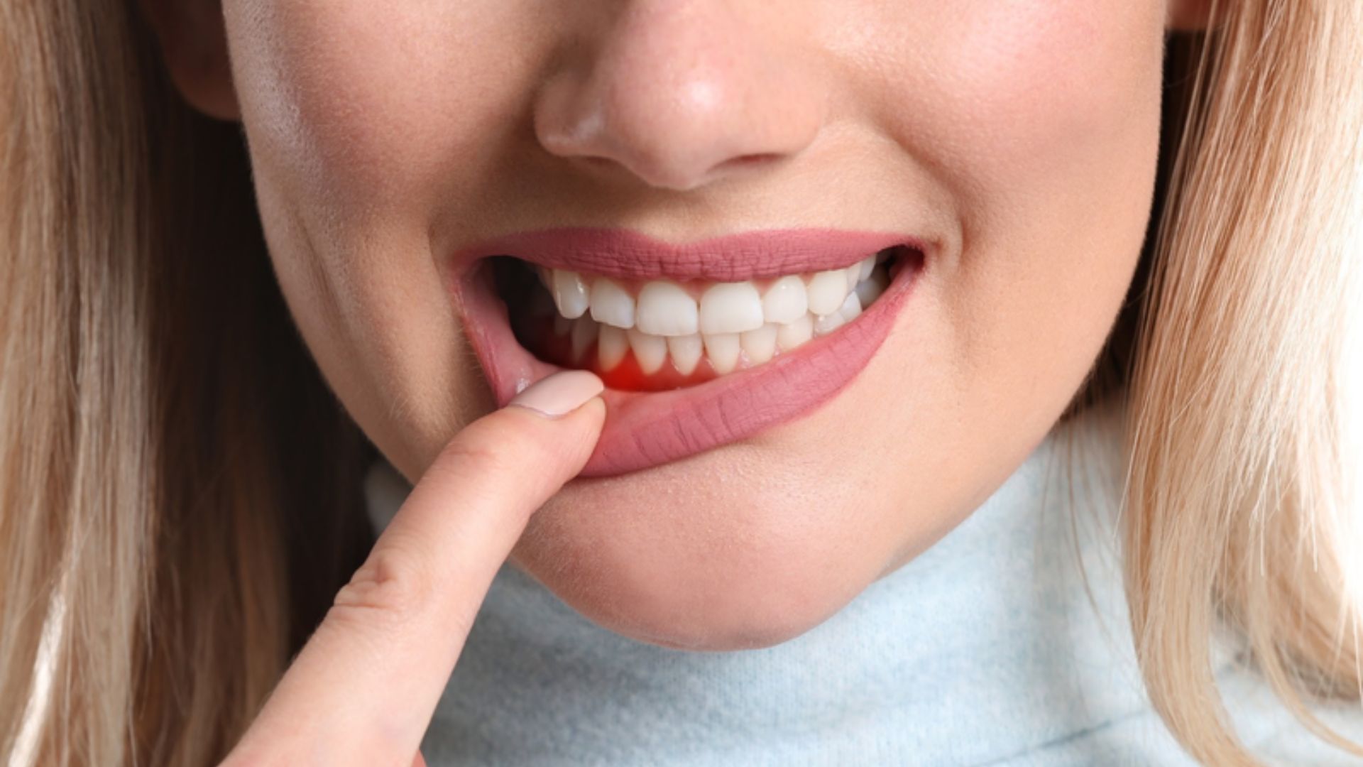 Răng bị lung lay là tình trạng mà nhiều độc giả đã và đang gặp phải