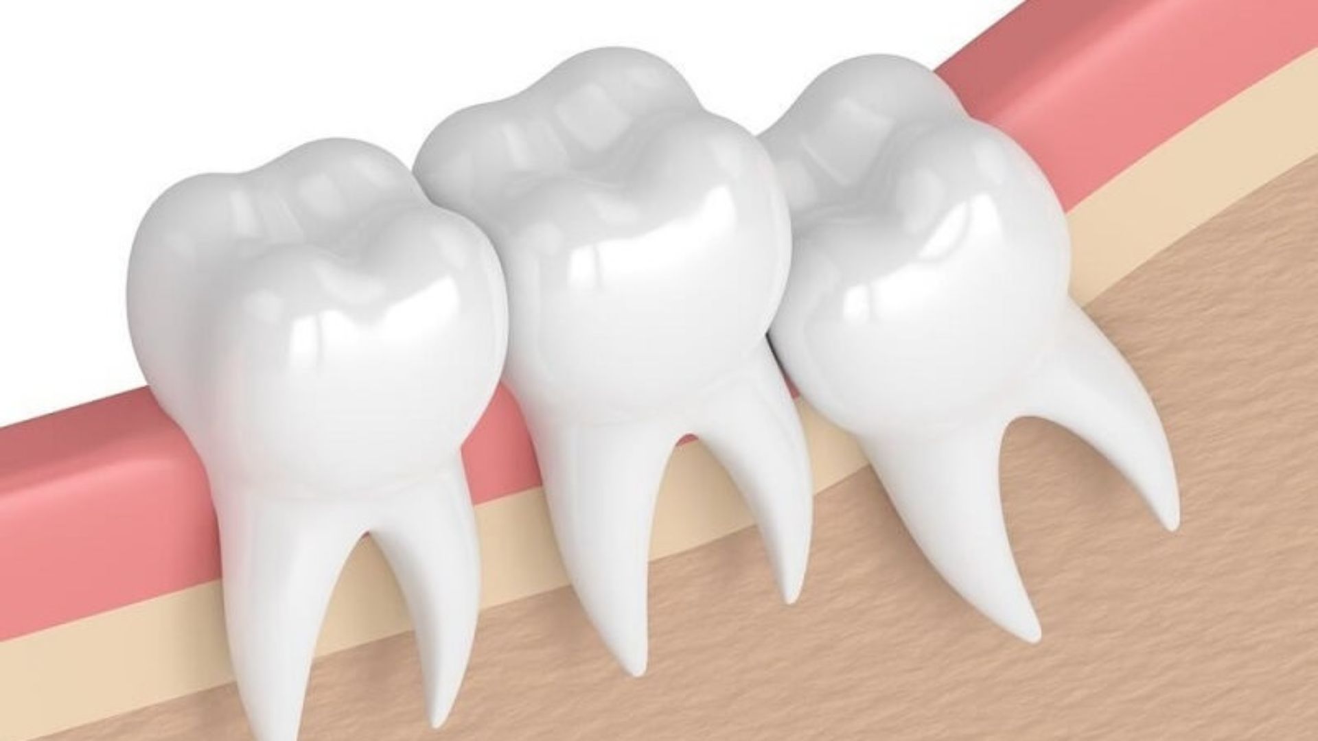 Răng khôn hay còn được biết đến với tên gọi khác là răng số 8