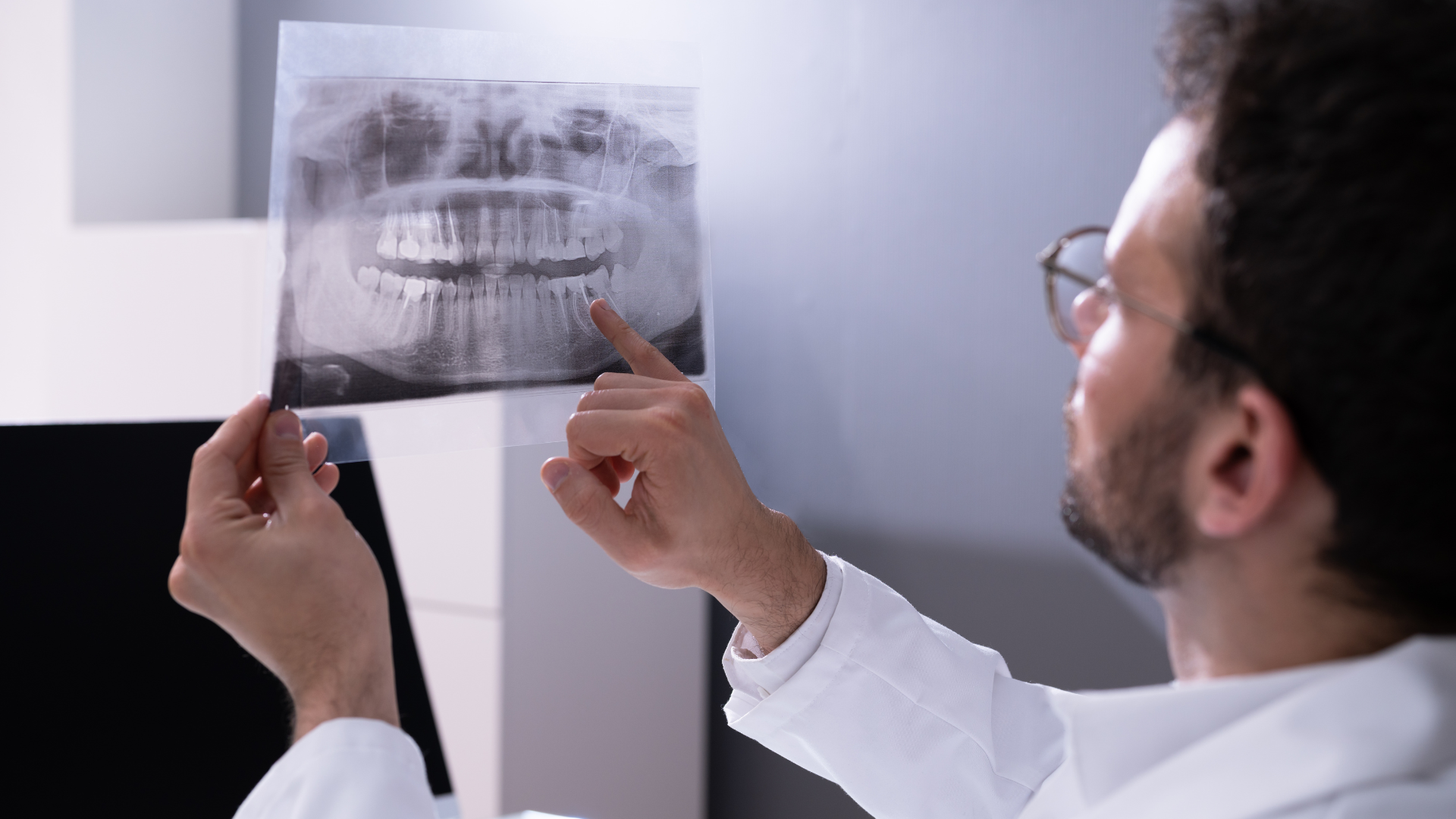 Chăm sóc răng miệng khoa học giúp hạn chế tác động của răng khôn mọc lệch đứng