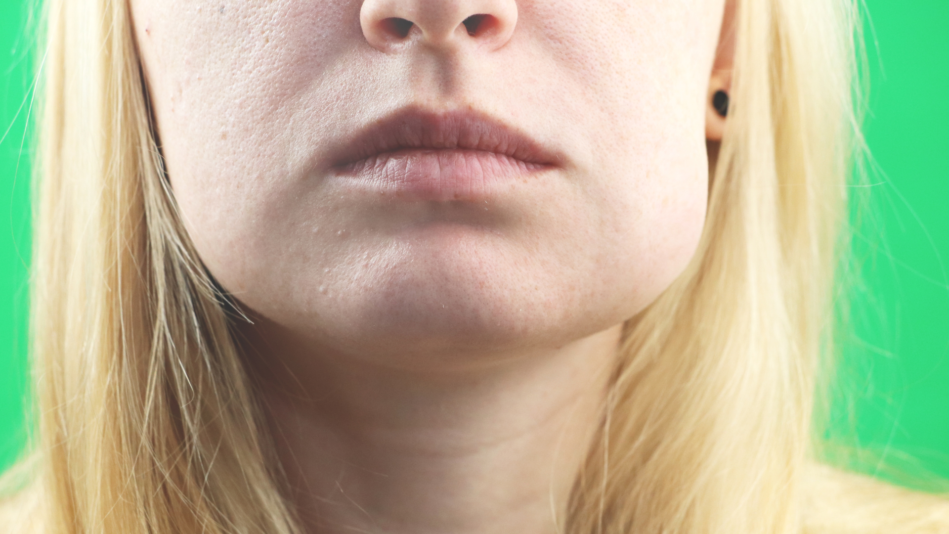 Sưng lợi hoặc sưng má cùng bên với chiếc răng có vấn đề là dấu hiệu cảnh báo nguy hiểm