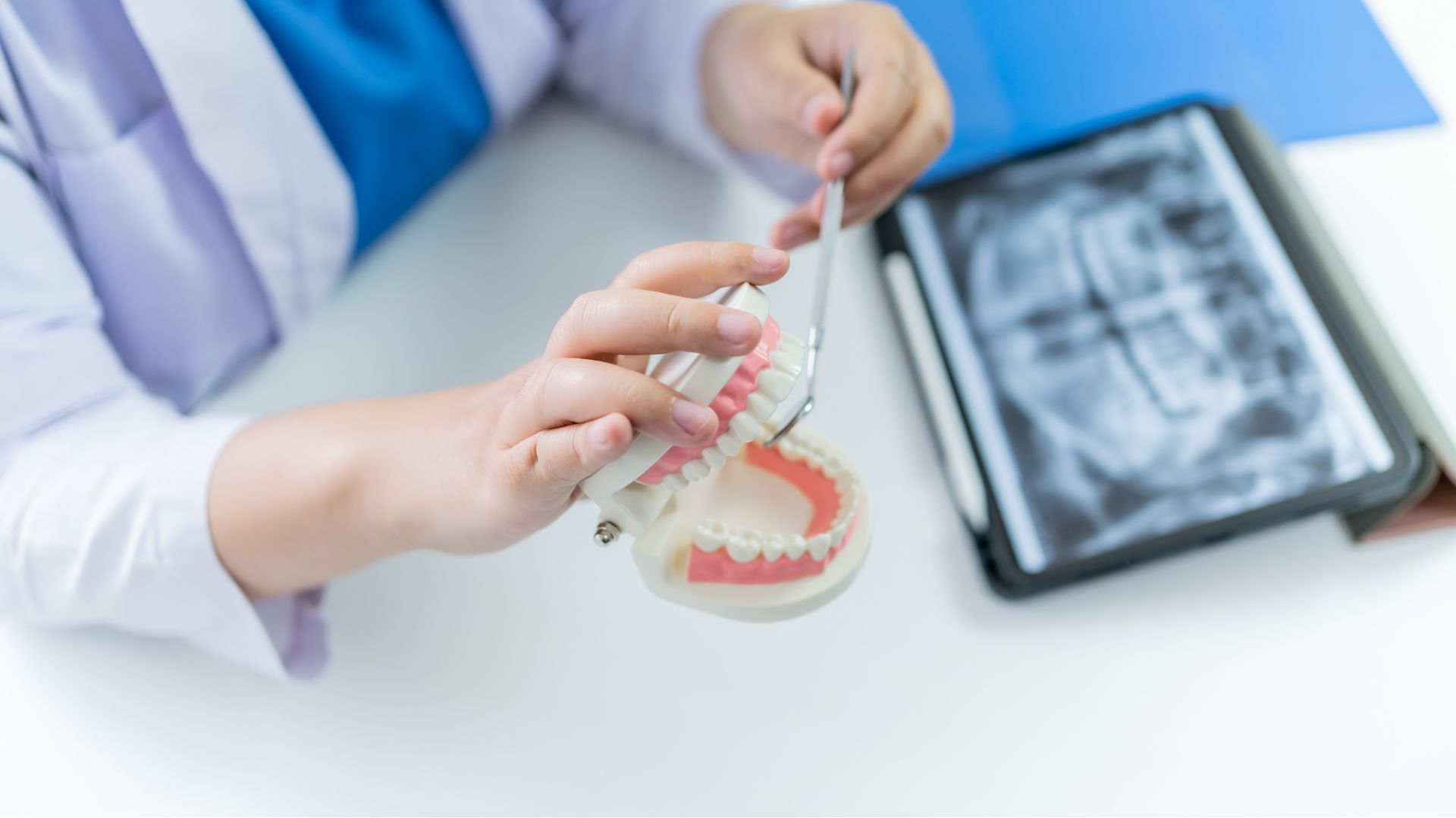 Áp dụng kỹ thuật điều trị bệnh lý răng hàm mặt sai cách gây tổn thương khớp cắn