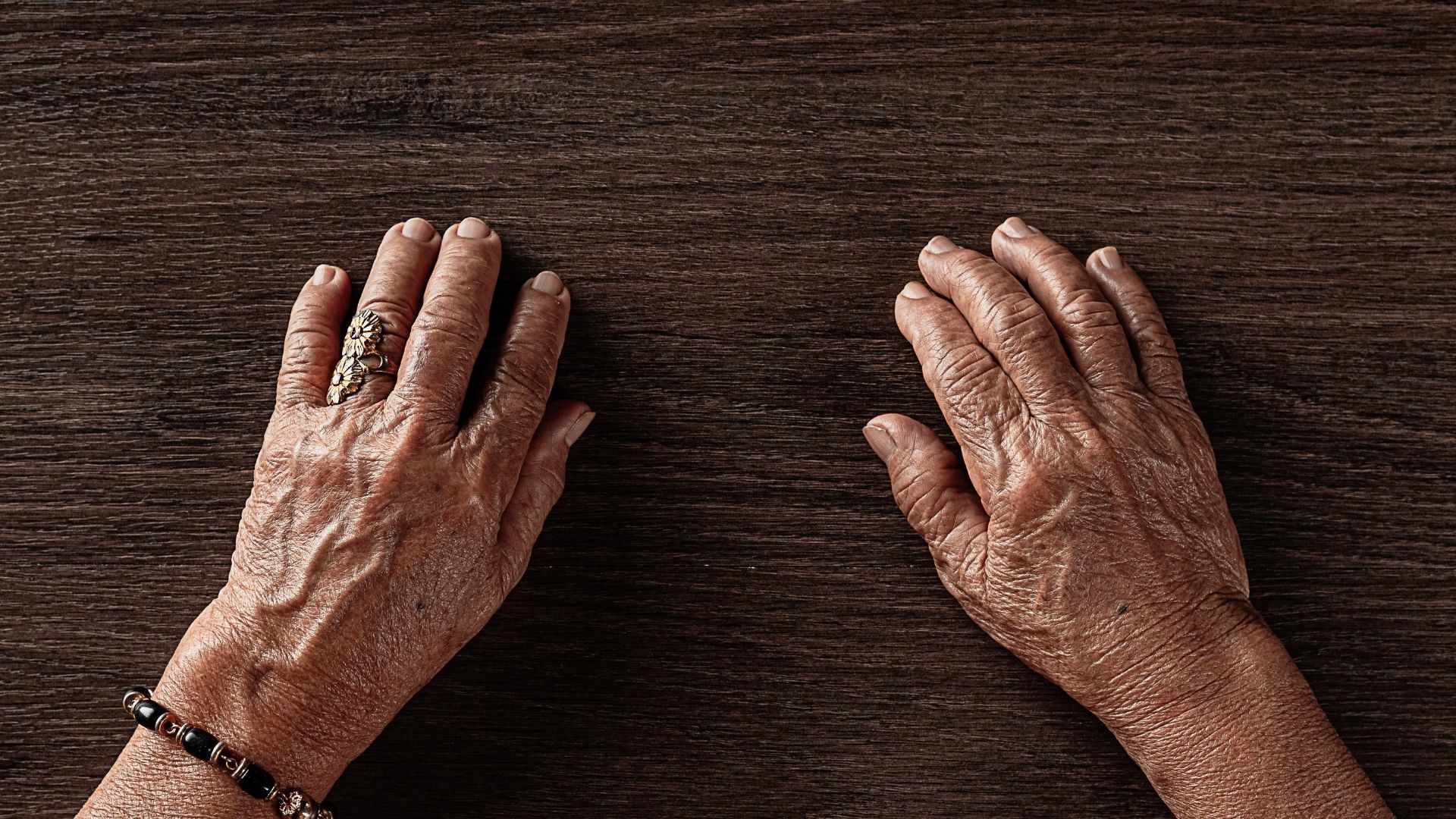 Rối loạn vận động có thể do bệnh lý thần kinh