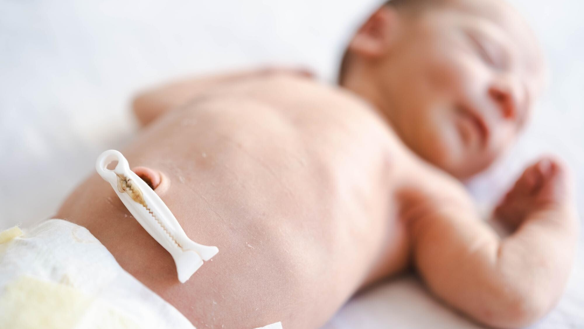 Rốn trẻ sơ sinh có mủ: Nguyên nhân và cách xử lý 3