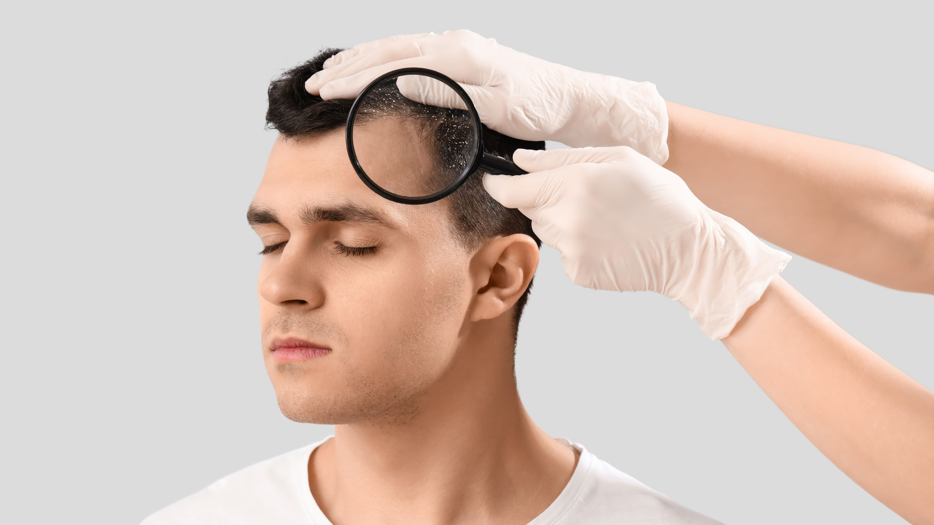 Khám tóc và da dầu để tìm nguyên nhân gây rụng tóc