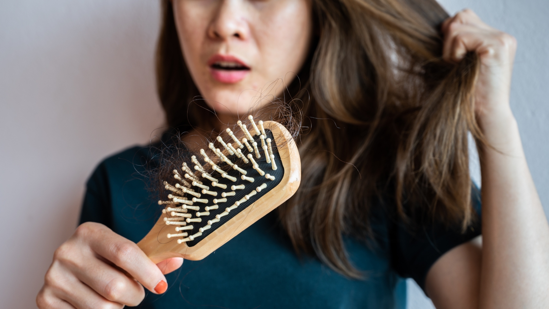 Ở đa số phụ nữ, rụng tóc sau sinh có thể kéo dài khoảng 3 - 6 tháng