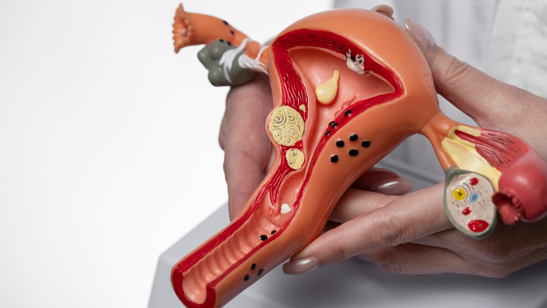 Quyết định phẫu thuật sửa sa bàng quang cần dựa trên tư vấn từ bác sĩ chuyên khoa