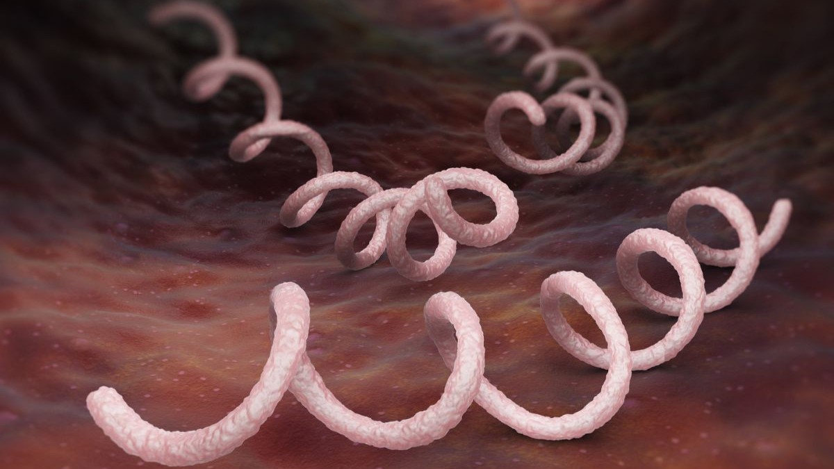 Sẩn giang mai xuất hiện do cơ thể nhiễm xoắn khuẩn Treponema pallidum