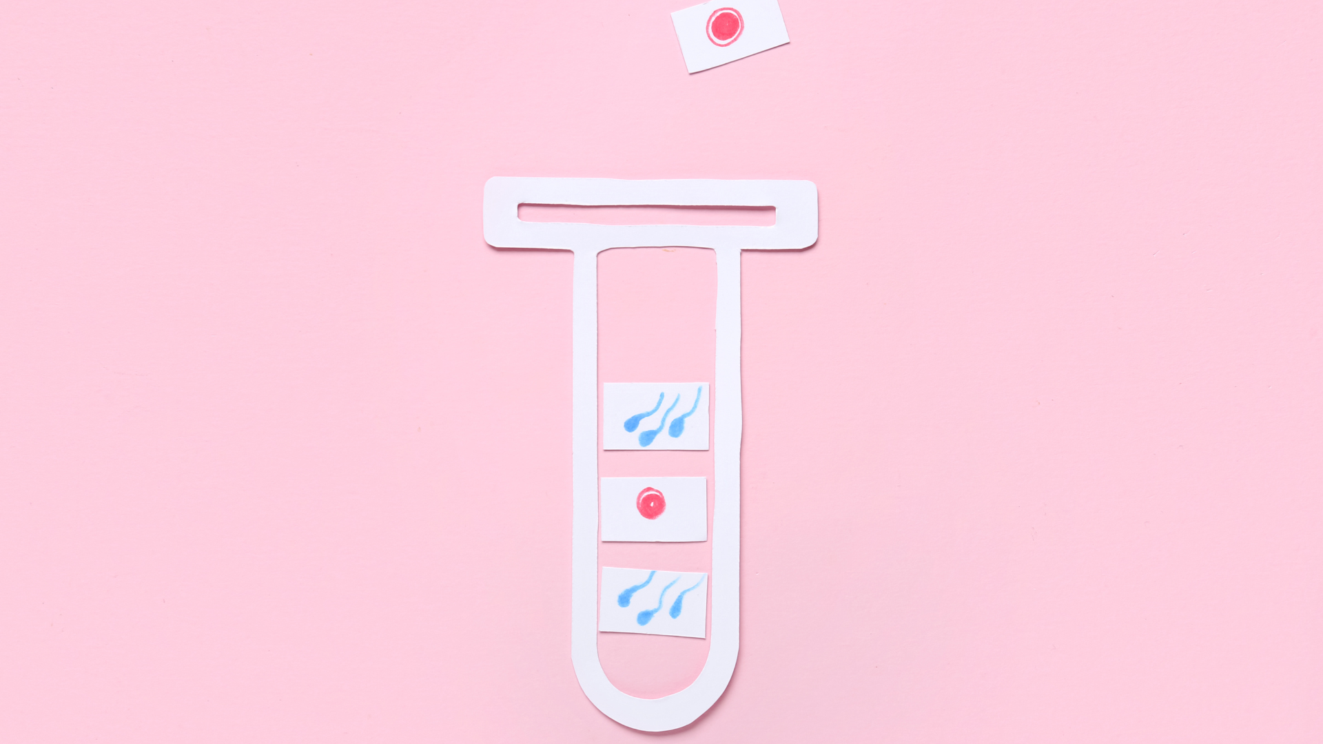 Quyết định thời điểm chuyển phôi không chỉ dựa trên phác đồ điều trị mà còn phụ thuộc nhiều yếu tố