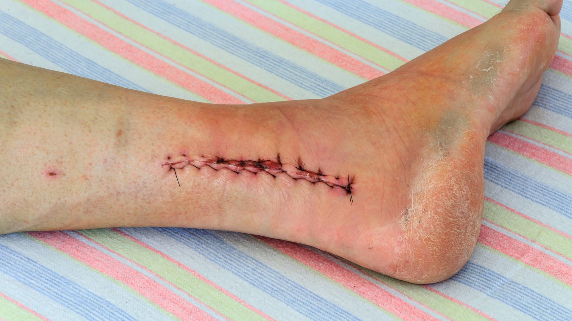 Ăn đậu đen đúng cách giúp hỗ trợ quá trình phục hồi vết thương