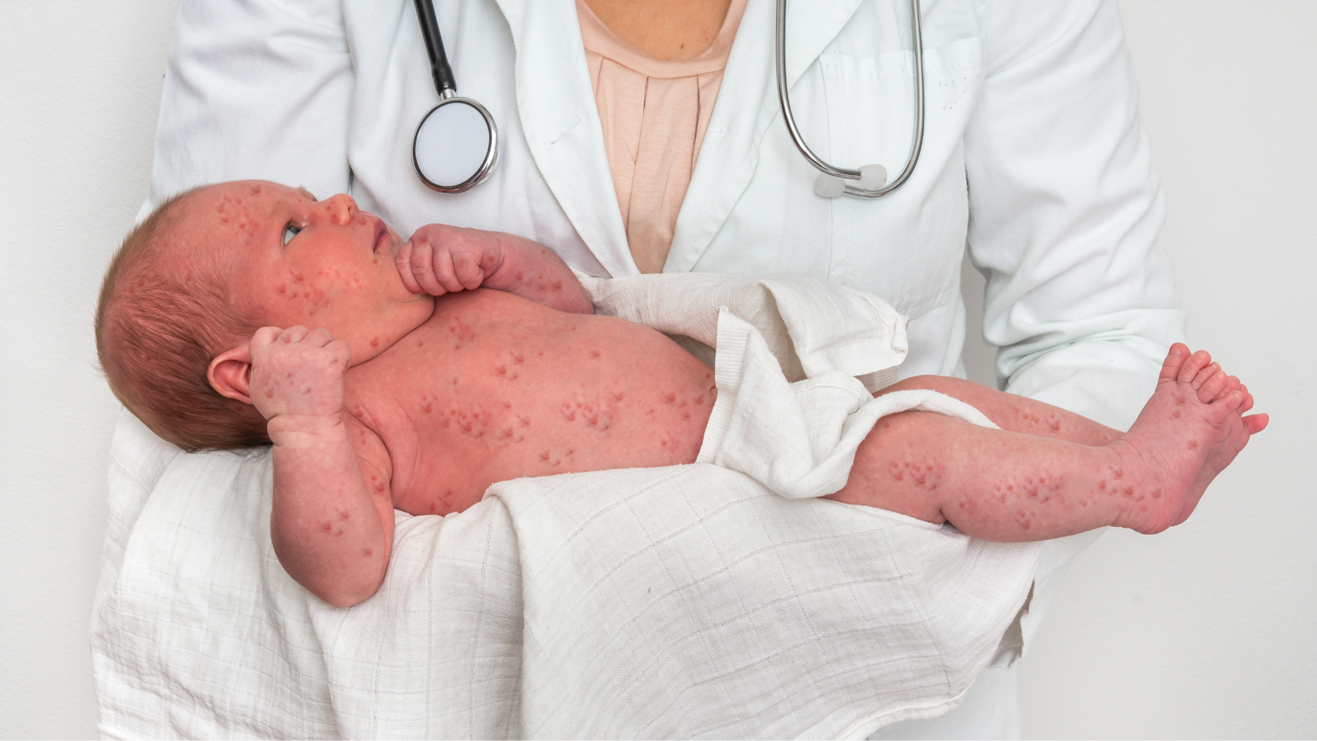 sau-say-thai-bao-lau-thi-tiem-phong-rubella-duoc (2).png