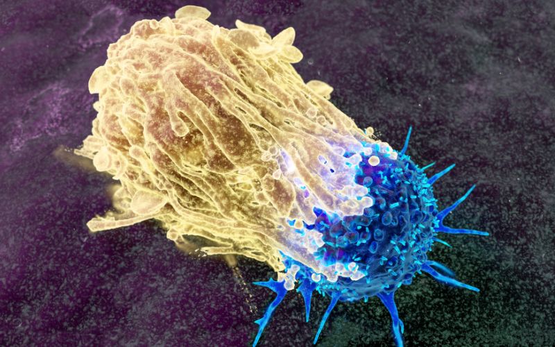 Xét nghiệm SCC tăng cao trong các bệnh lý ác tính