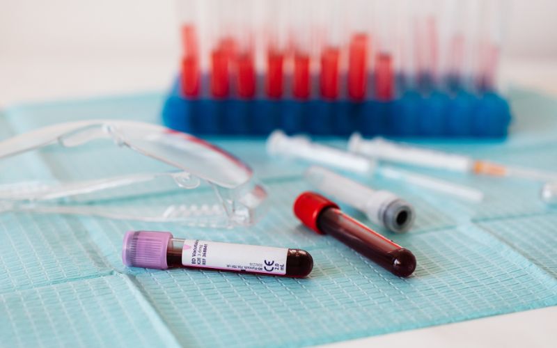 SCC là xét nghiệm gì​? Đây là xét nghiệm giúp định lượng nồng độ kháng nguyên ung thư tế bào vảy