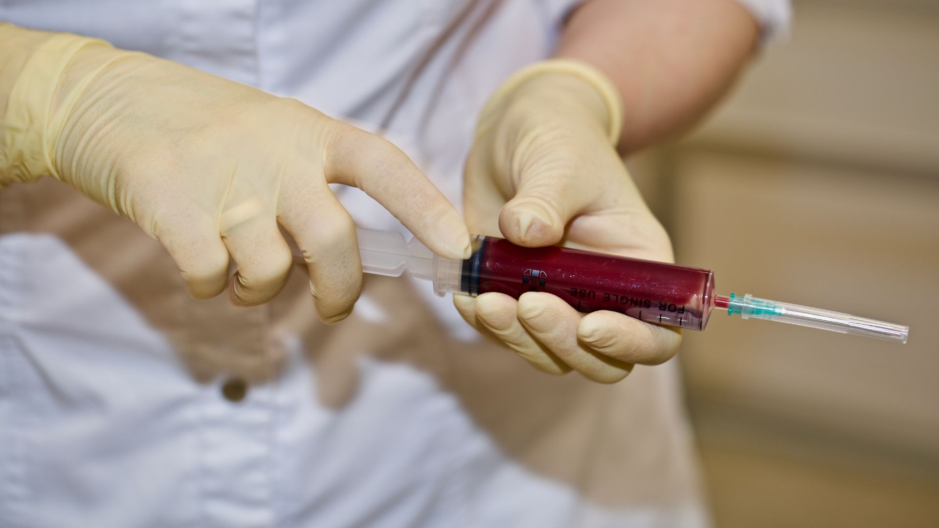 Mẫu bệnh phẩm để thực hiện xét nghiệm SHBG là máu tĩnh mạch