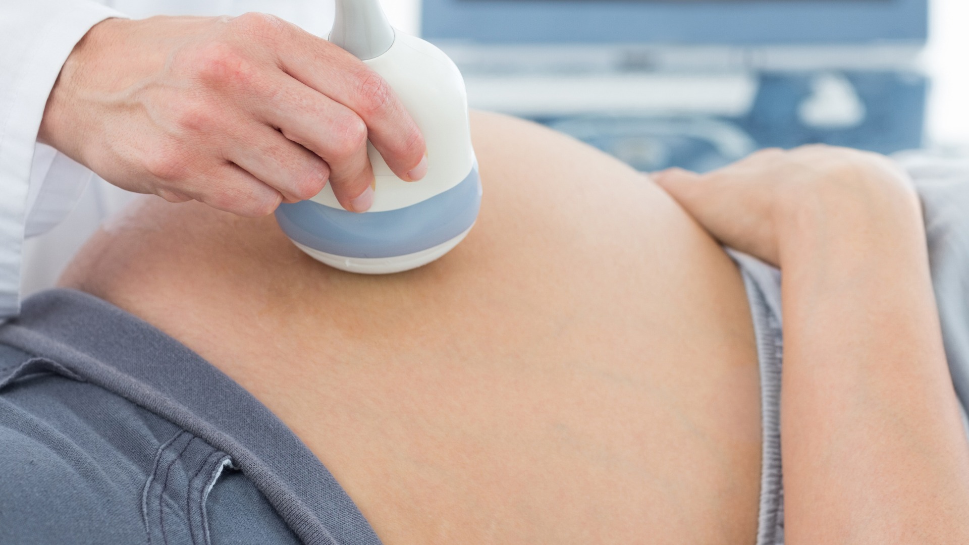 Thai nhi 18 tuần hoàn toàn có thể siêu âm 4D