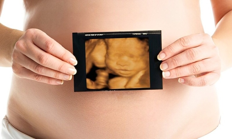 Siêu âm 4D thai 18 tuần có thể thấy rõ nét khuôn mặt, tay chân và hoạt động của bé