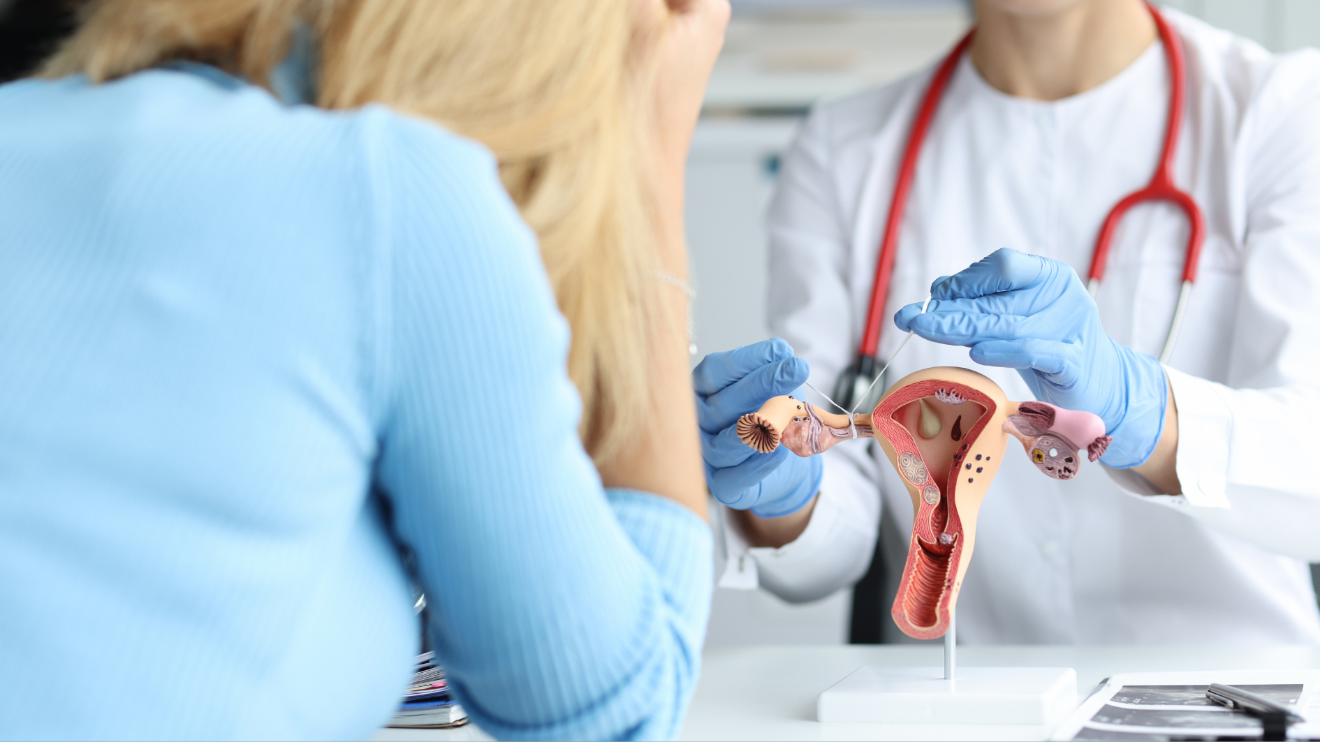 Siêu âm đầu dò có biết tắc vòi trứng không? 3