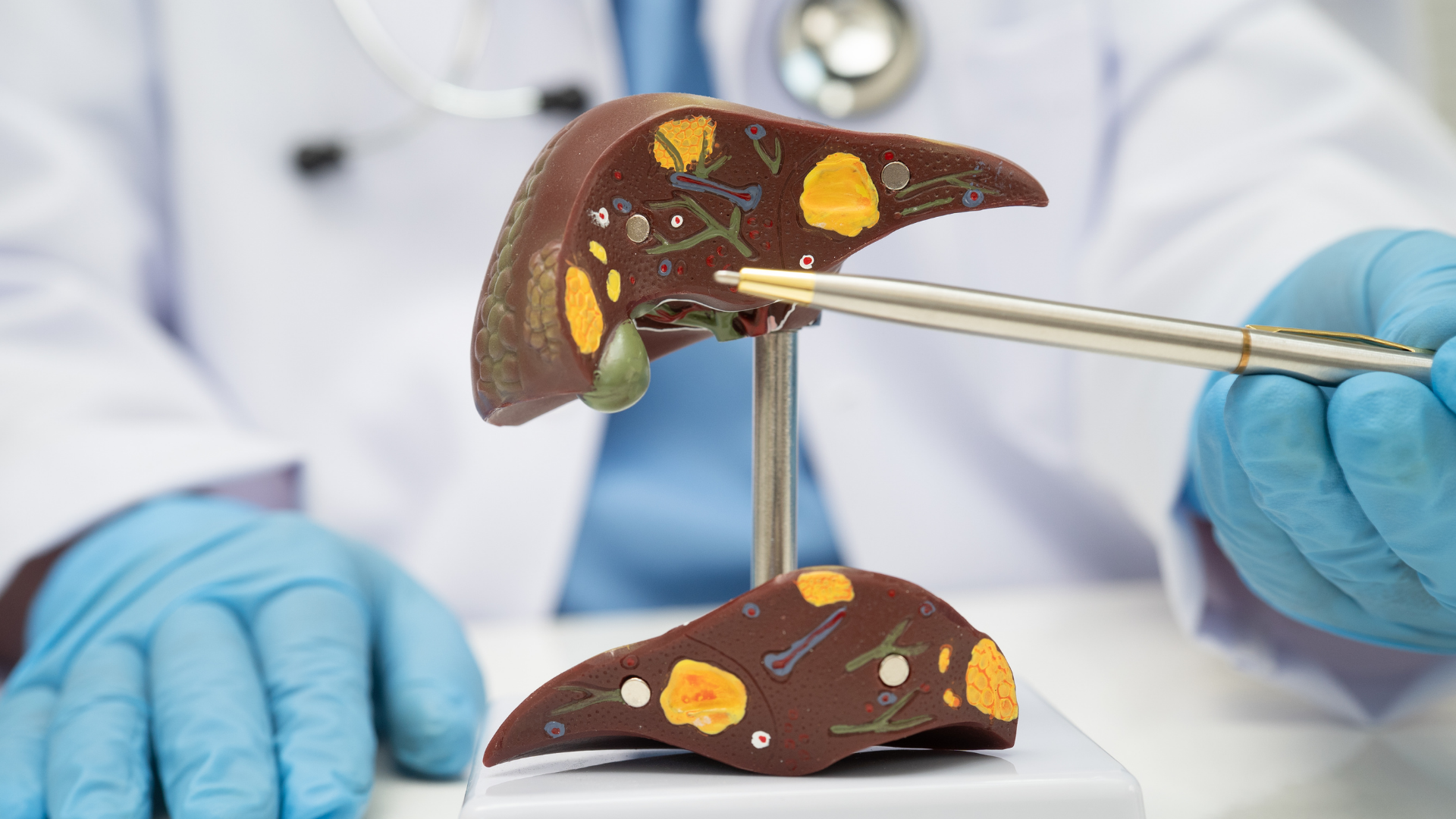 Các yếu tố làm thay đổi chi phí siêu âm gan