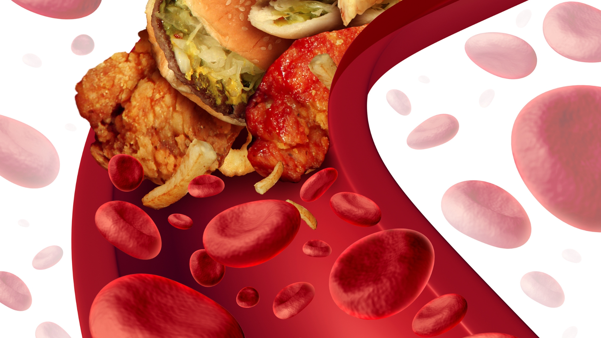 Nhiều bệnh lý mạch máu có thể phát hiện bằng siêu âm mạch như hẹp động mạch do tích tụ mảng bám