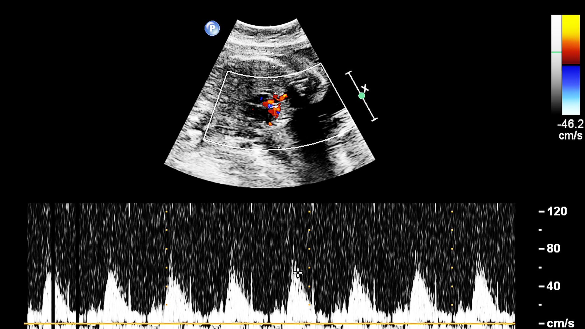 Siêu âm tim thai là kỹ thuật dùng sóng siêu âm để quan sát và đánh giá cấu trúc bên trong tim thai nhi