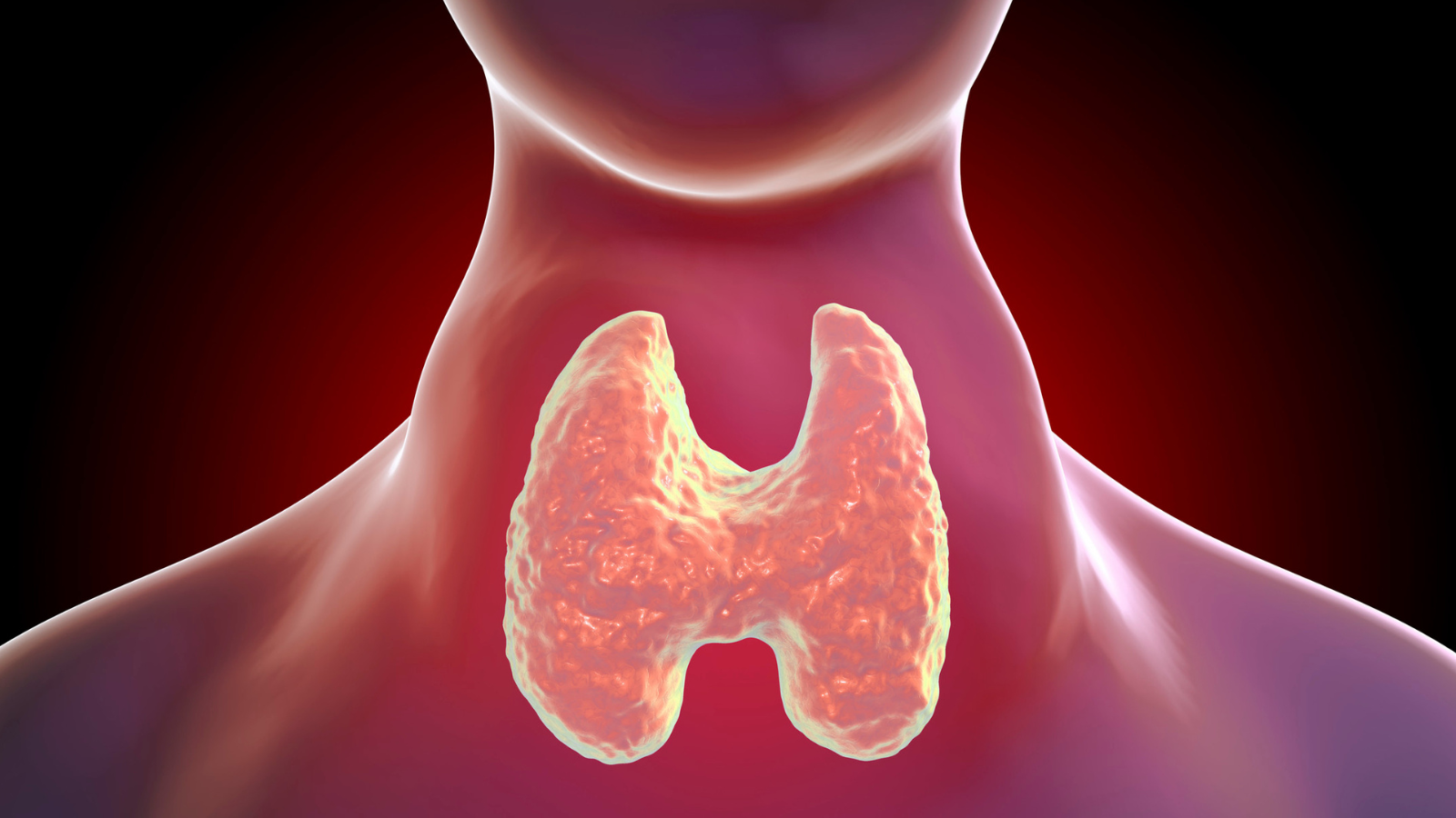 Bác sĩ có thể chỉ định phẫu thuật cắt bỏ khối u hoặc tuyến giáp